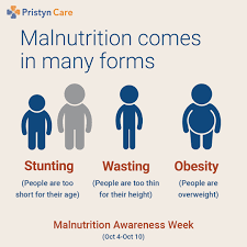 malnutrition